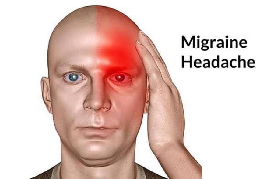 Typical Migraine Headache