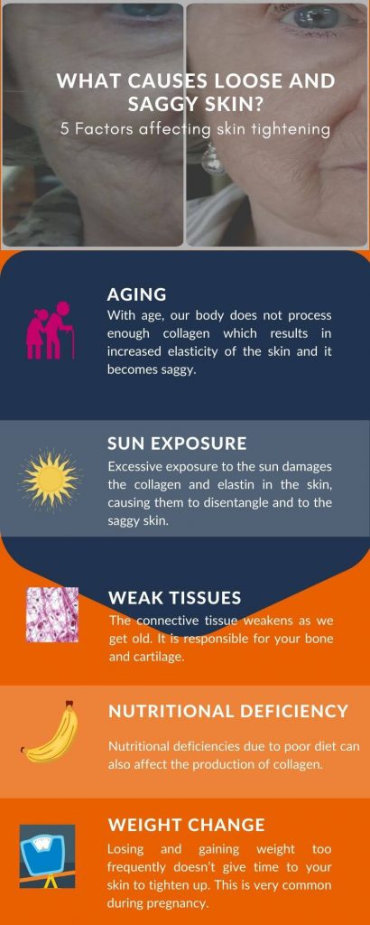 causes of saggy skin