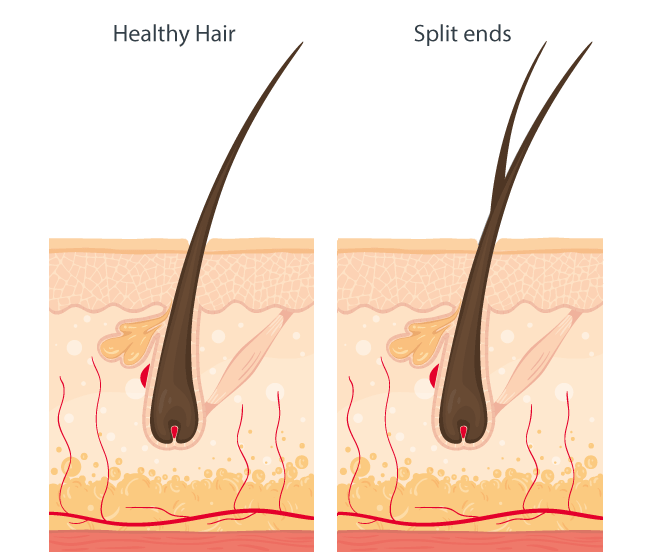 Hair Problems and their different types of Treatments »