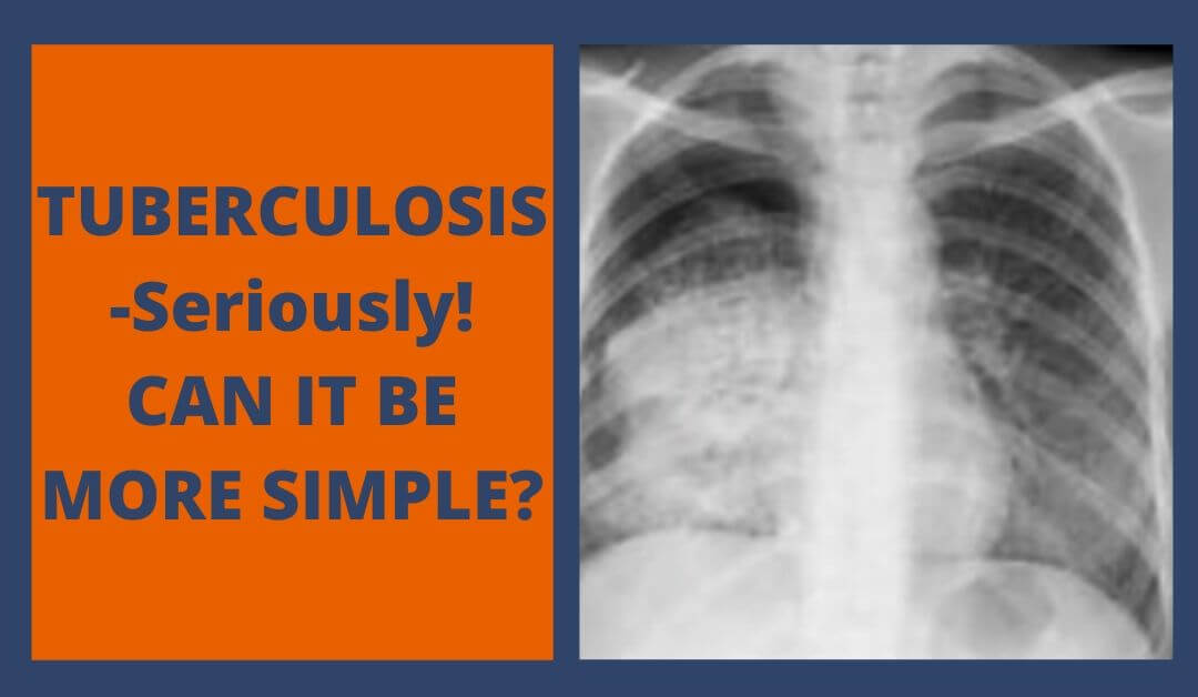 TUBERCULOSIS-Seriously! CAN IT BE MORE SIMPLE?