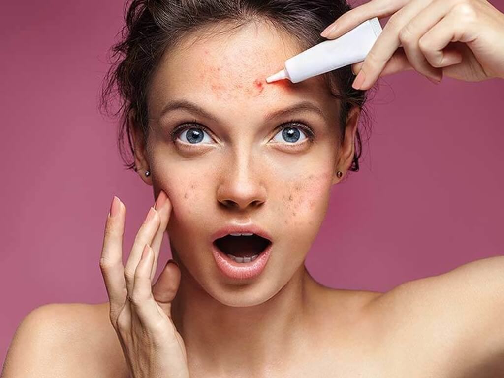 Skincare for acne