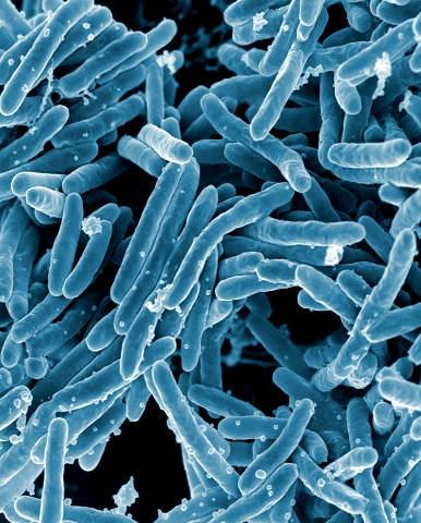 microscopic bacteria view