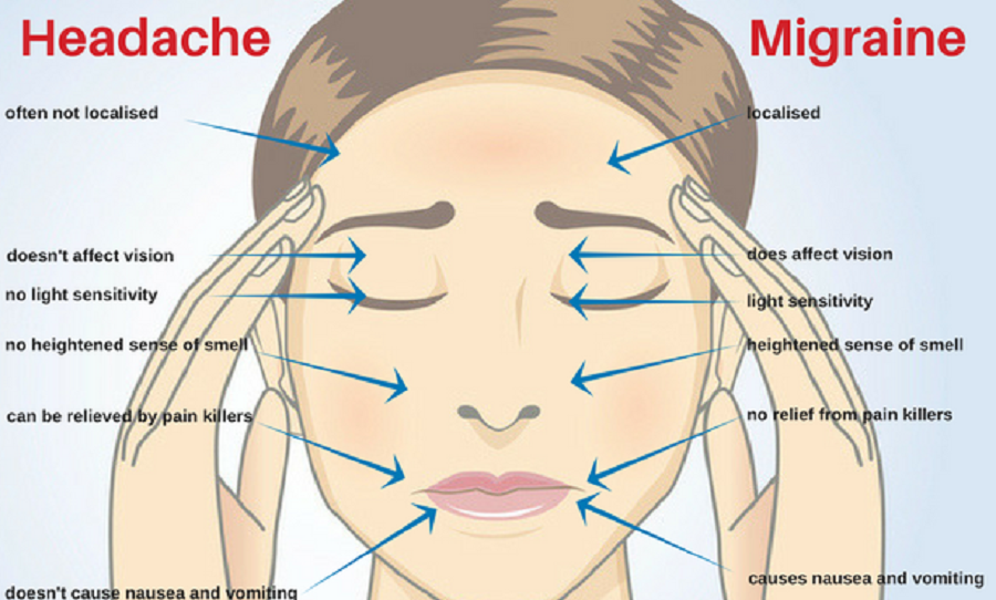 Symptoms of Migraine