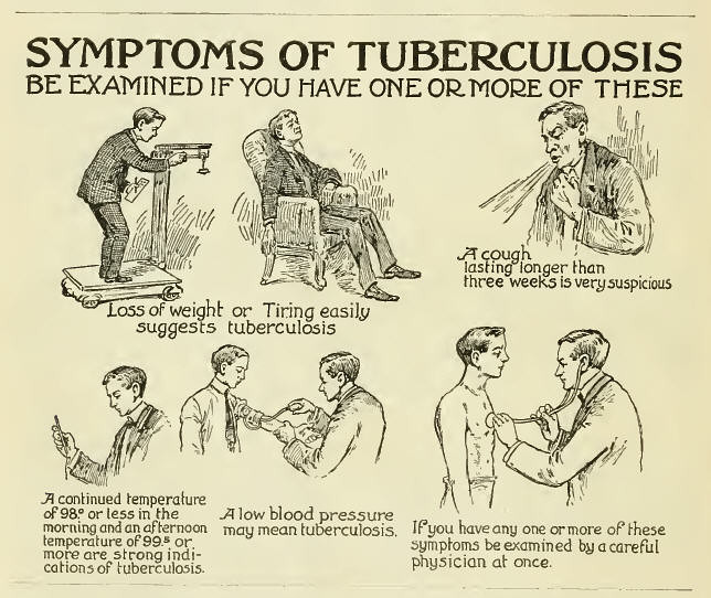 tuberculosis symptoms and signs